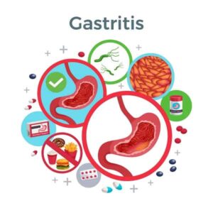 Gastritis Management with Natural Juices